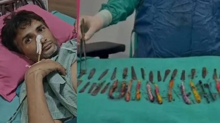 हापुड़ में शख्स के पेट से निकले 60 से ज्यादा अजीबो-गरीब सामान, डॉक्टर भी हैरान