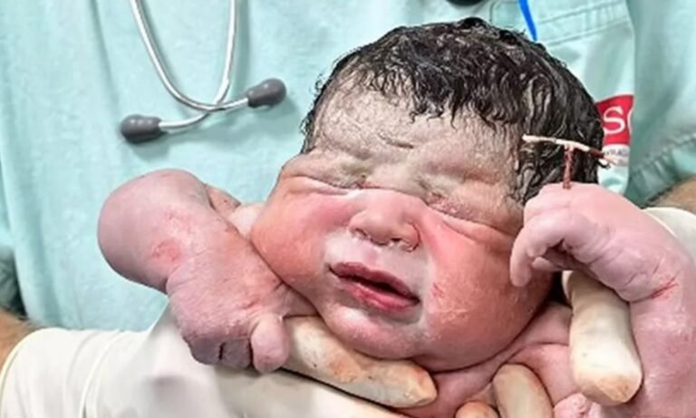 ब्राज़ील के बच्चे Matheus Gabriel ने IUD कॉइल को थामकर इंटरनेट पर मचाया तहलका